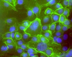 http://stemcells-research.net/wp-content/uploads/2011/07/cancer-stem-cell3.jpg